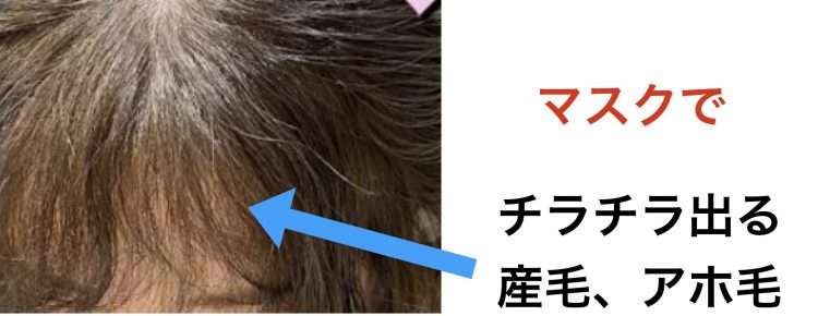 緊急！マスクで前髪がうねる・くせ毛になる3つの原因と対処法！うねりに悩む現役美容師解説【森越 道大】公式サイト│GARDEN所属のパーマ美容師