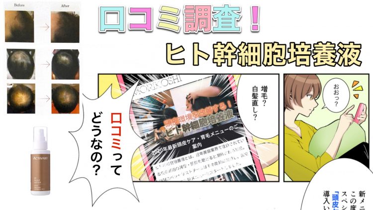 ヒト幹細胞培養液スカルプローションの口コミ【2023年度版】育毛効果はあるのか？